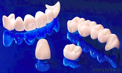 Циркониевая керамика в стоматологии
